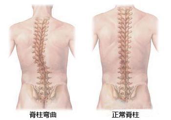 脊柱