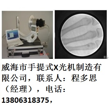 威海市手提式X光机-26-300