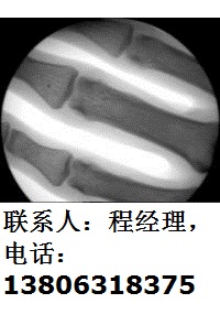 威海市手提式X光机-50-200-该机透视手指效果