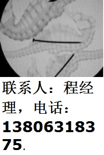 威海市手提式X光机-80-100-透视虫草效果