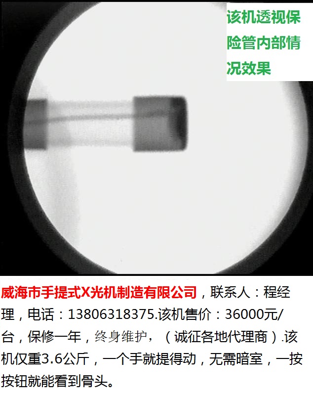 威海市手提式X光机-71-500-透视保险管效果