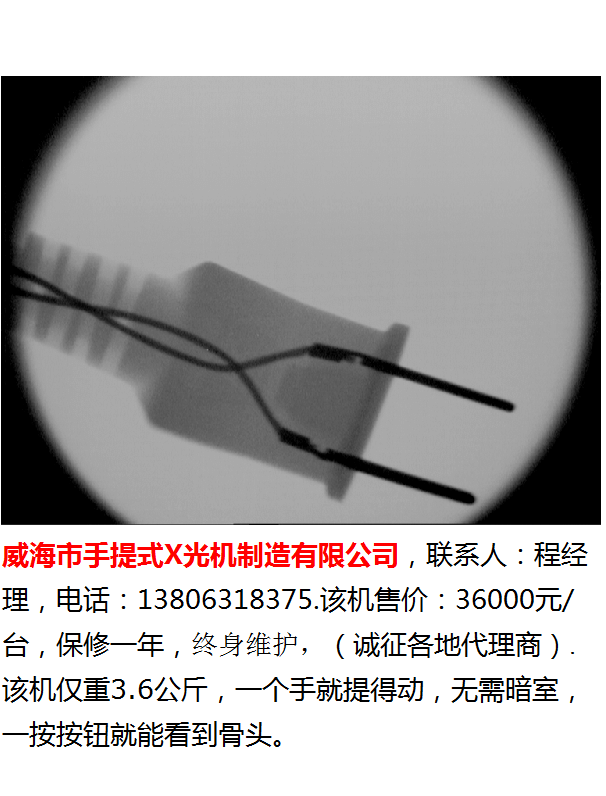 威海市手提式X光机-62-400-透视插头效果