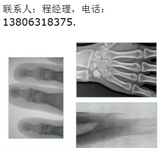 威海市手提式X光机-68-300-透视三张效果
