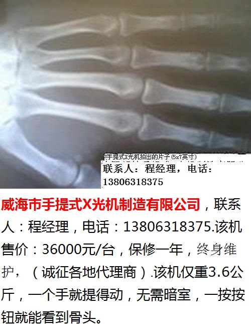威海市手提式X光机-5-400