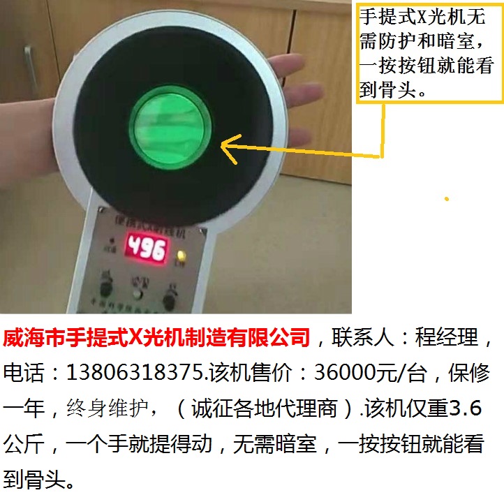 威海市手提式X光机-50型透视手掌