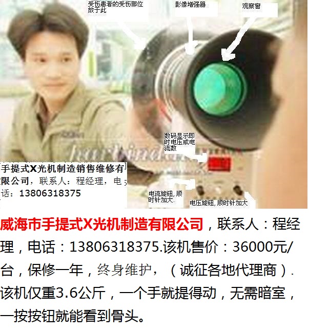 手提式X光机-3-400