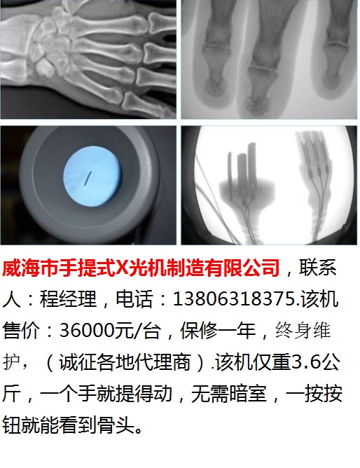 威海市手提式X光机-79-400-透视四图效果