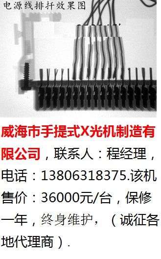 威海市手提式X光机-88 (3)
