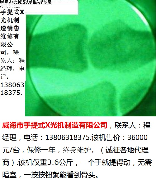 手提式X光机-4-绿屏-手指-400